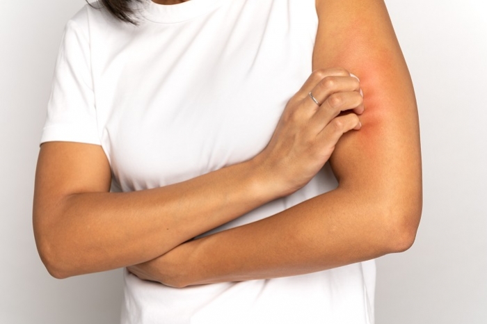 Kosmetyki hypoalergiczne – must have dla skóry wrażliwej